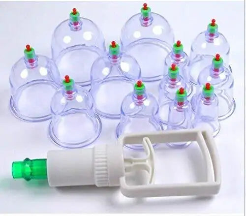 Electric cupping therapy machine with suction cups for effective acupressure treatment