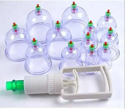 Electric cupping therapy machine with suction cups for effective acupressure treatment