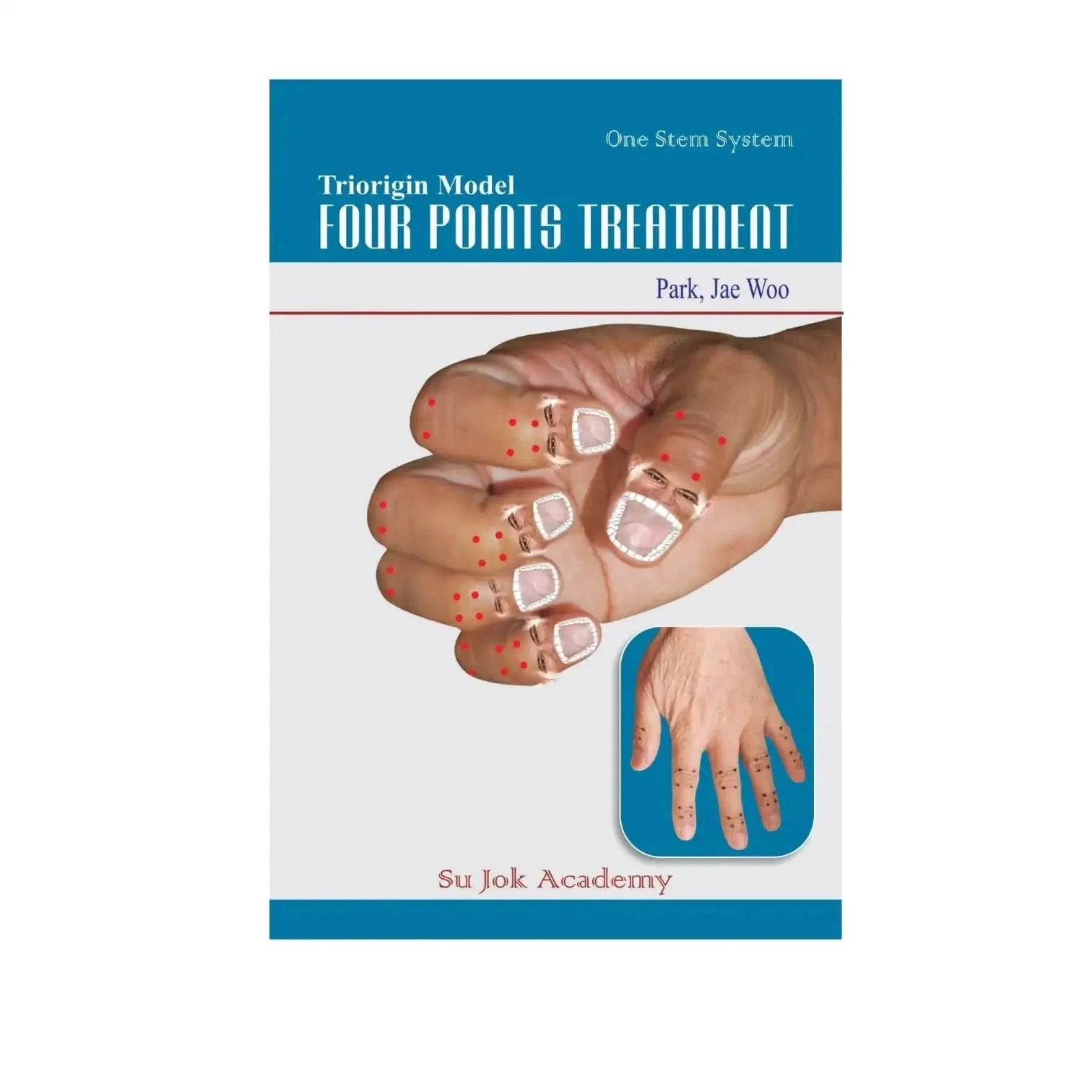 Acupressure treatment book cover with “One Stem System” text and hand pressure point layout